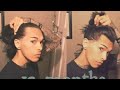 Men's Hair Growth Journey (1 YEAR) Compilation - Months 1-12