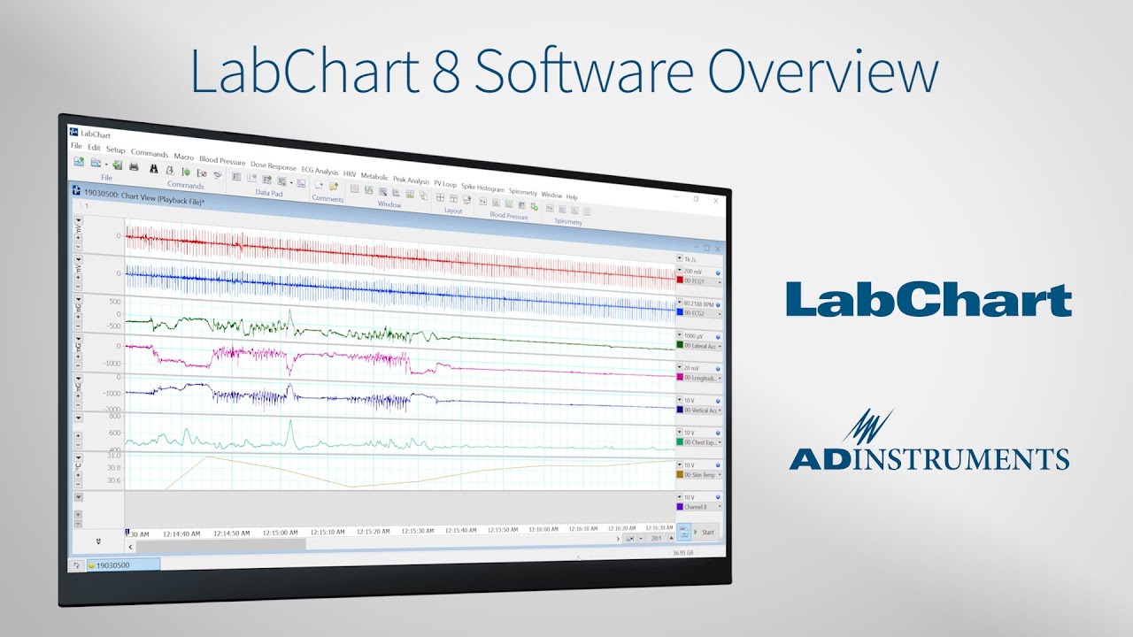 Labchart Manual at Kathleen Delgado blog