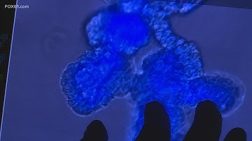 FIRST ON FOX61: 45 cases of NY COVID variant identified in Connecticut