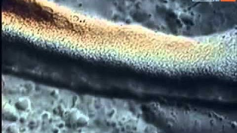 Dictyostelium discoideum