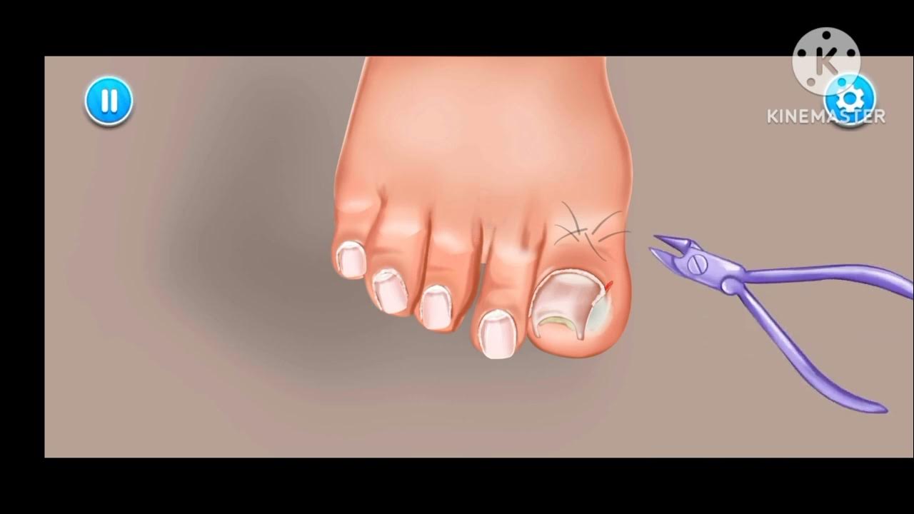 Nail treatment at home remedies Nail cleaning asmr animation YouTube