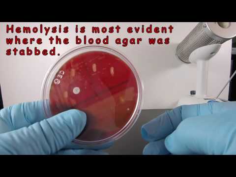 Video: Hoe op hemolyse controleren?