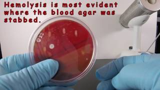 Beta Hemolysis on Blood Agar