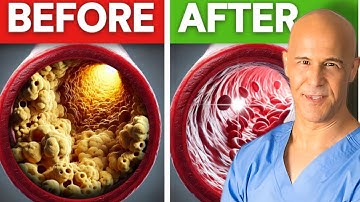 BEST Meal to Prevent a Heart Attack and Stroke | Dr. Mandell  |
