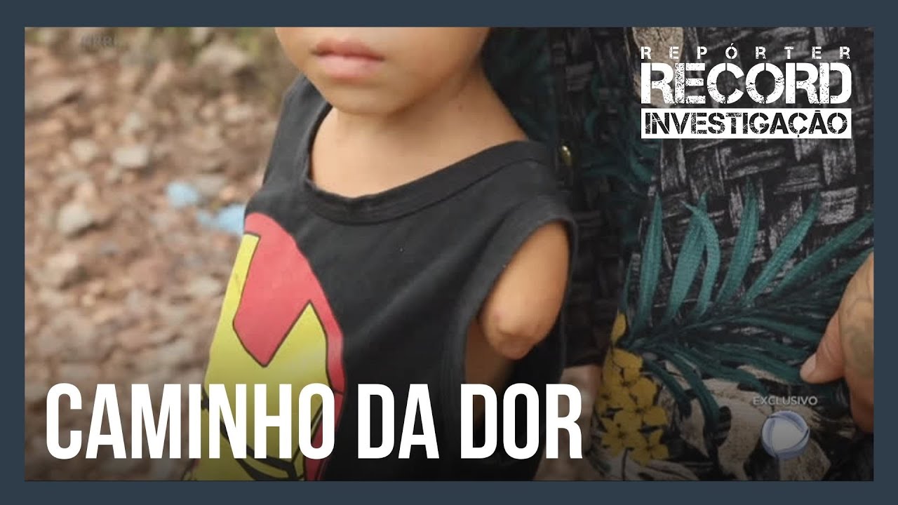 Falta de passarelas expõe moradores à rotina de acidentes em travessias pela ferrovia Carajás