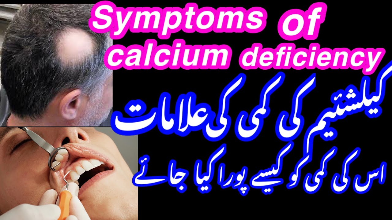 calcium ki kami ki alamat/symptoms of calcium deficiency calcium rich