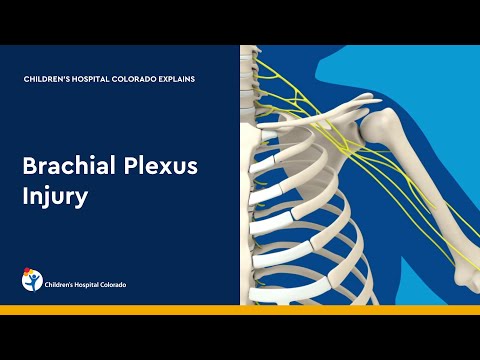 Brachial Plexus Injury