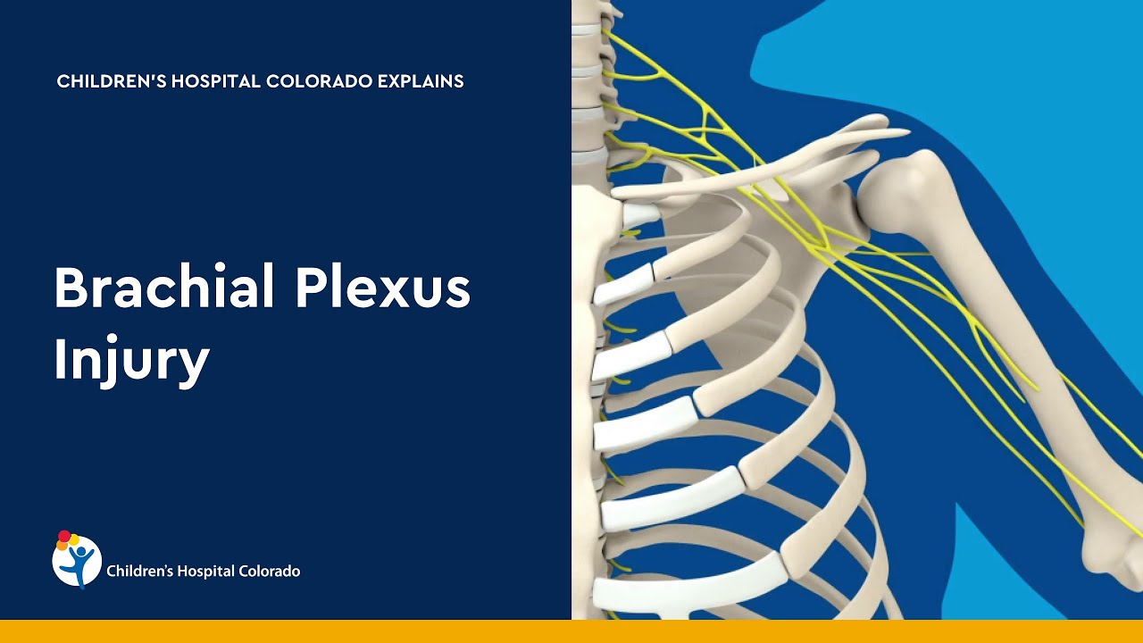 Brachial Plexus Injury