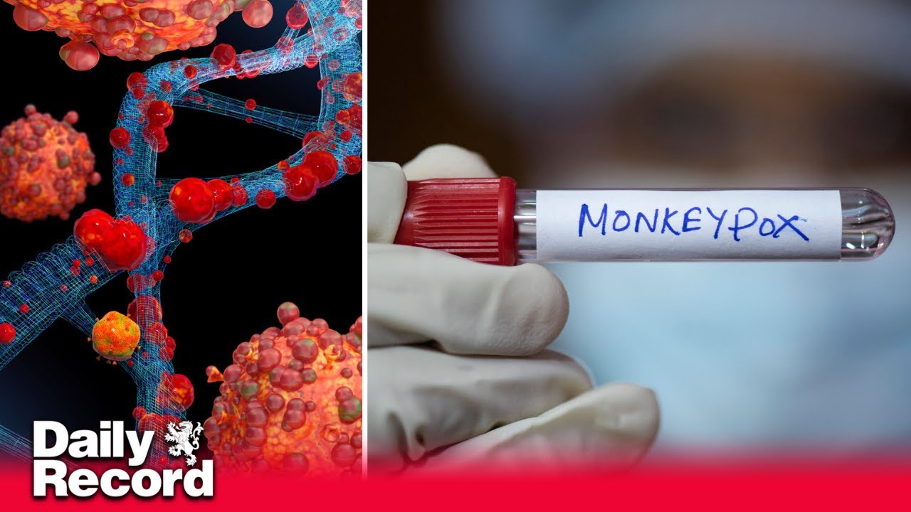 Mpox - What is the new potentially deadly strain detected in the UK ...