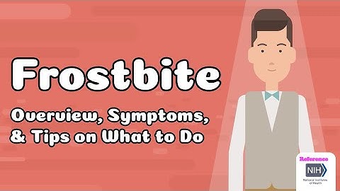 Frostbite - Overview, Symptoms, & Tips on What to Do