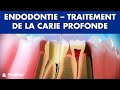 Endodontie - Traitement de la carie profonde ©