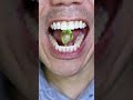 ASMR | Diamond Hard Candy #DoctorTristanPeh #ASMR