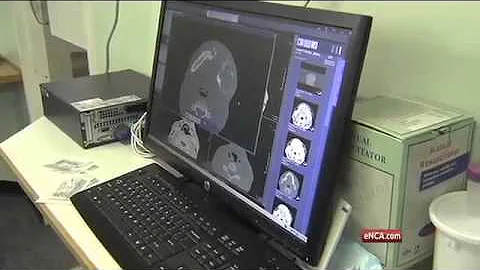 3D printing could herald a new era in prosthetic technology