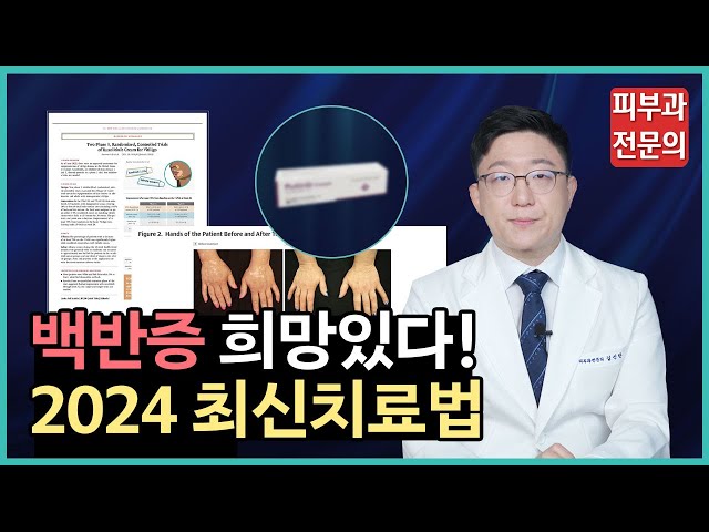 백반증 포기하지 마세요! 희망있습니다! ㅣ백반증치료ㅣ백반증최신치료법ㅣ옵젤루라