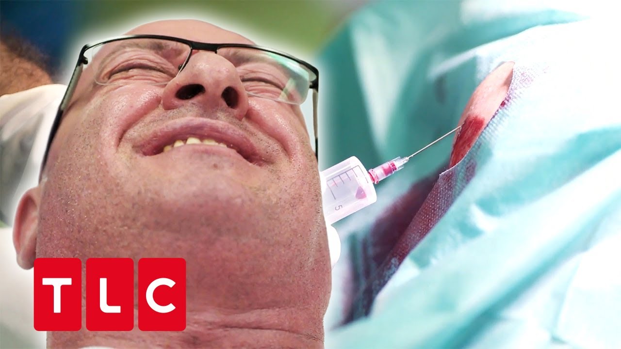 300ml Flüssigkeit aus dem Knie entfernt?! 💦👀 | Notaufnahme: Samstagnacht | TLC Deutschland