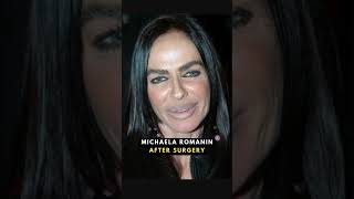 ?? Plastic surgery fails ?? | Never touch the face with surgery comparison nowandthen trending