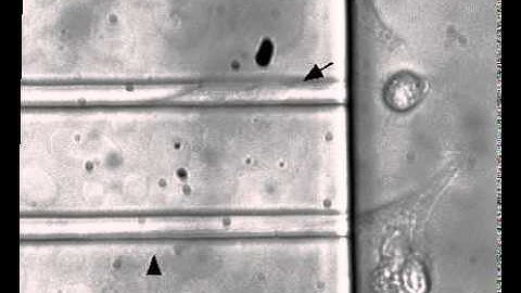 Microdevices to study cancer cell invasion (glioma)