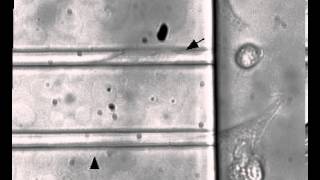 Microdevices to study cancer cell invasion (glioma)