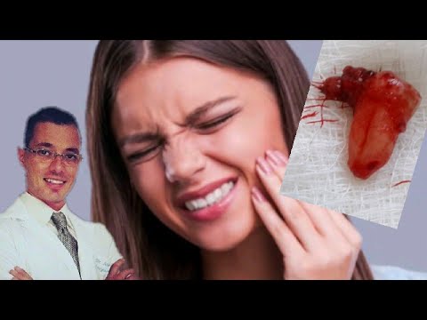 Vídeo: Para Que Os Dentes Não Doam