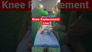 Knee Replacement | Live surgery | Joint Replacement | Orthopedic Surgeon life