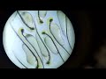 Личинка Линя под микроскопом