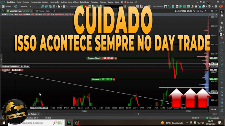 🚫Por Esse Motivo temos que manter a Concentração no Day Trade
