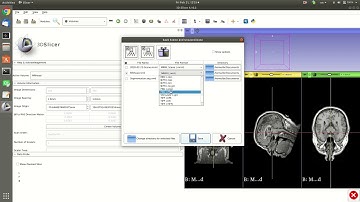 Slicer 2020 03 Converting between medical file formats