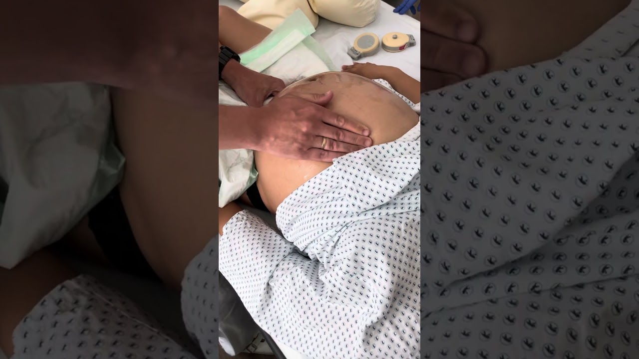 Äußere Wendung ECV andere Perspektive