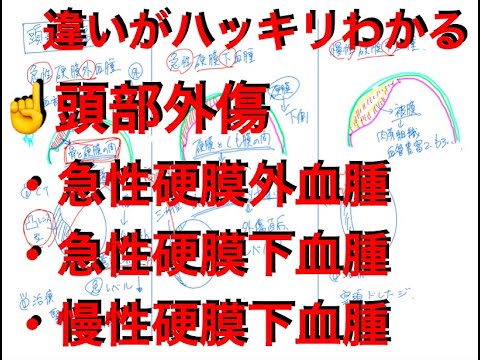 ［頭部外傷］〜急性硬膜外血腫・急性硬膜下血腫・慢性硬膜下血腫〜