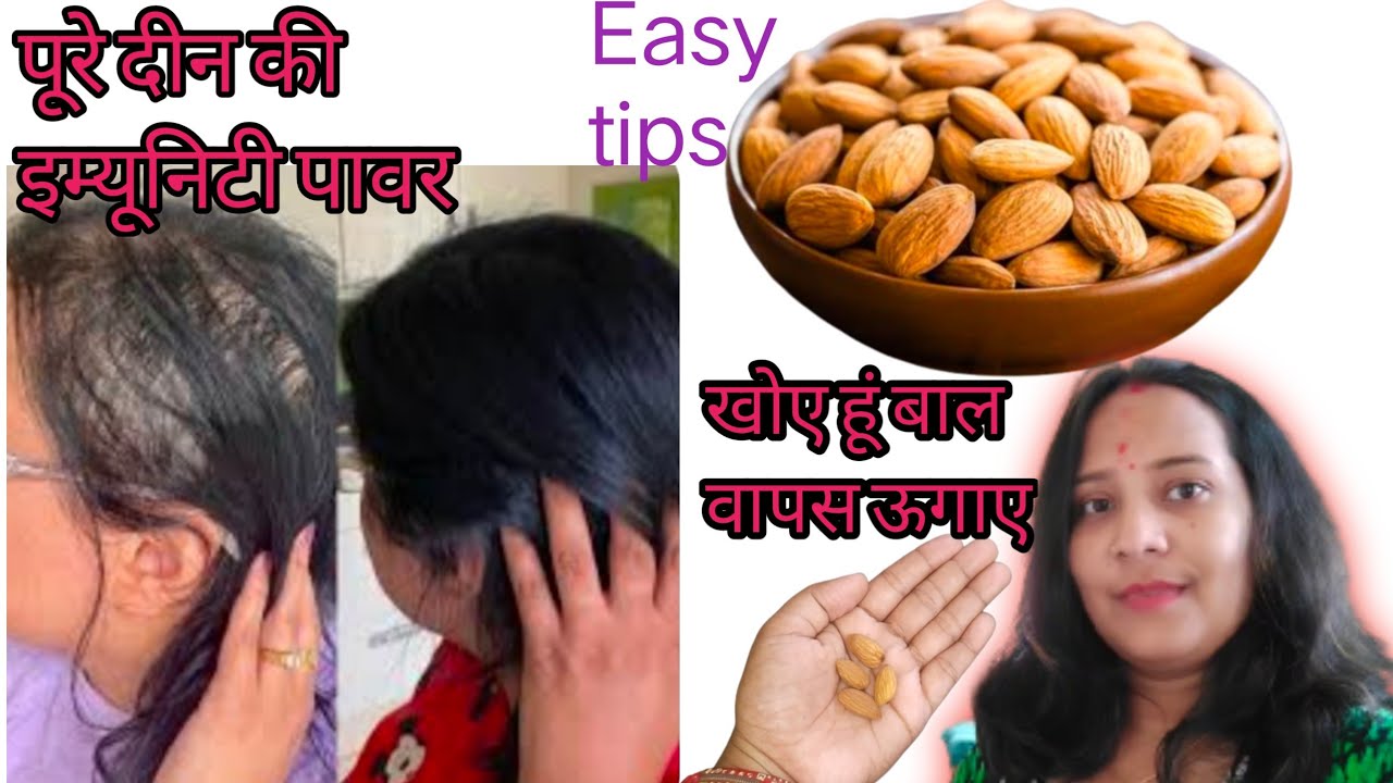 Health Benefits Eating Almonds Daily Reduces Hairfall How To Eat health-benefits-eating-almonds-daily-reduces-hairfall-how-to-eat