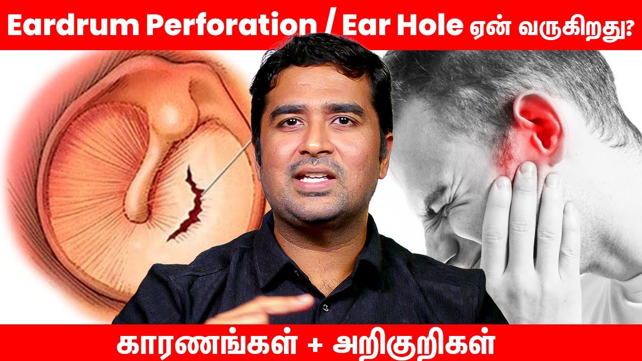 காது தட்டு துளை (Ear Drum Perforation / Ear Hole) ஏன் வருகிறது? காரணங்கள் + அறிகுறிகள்