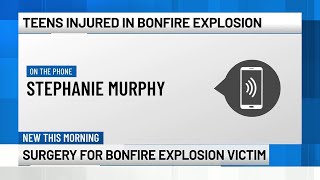 "Nobody told me my son was injured": Mom of one teen hurt in bonfire incident