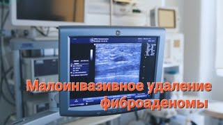 Вакуум-ассистированная тотальная биопсия фиброаденомы (малоинвазивное удаление)