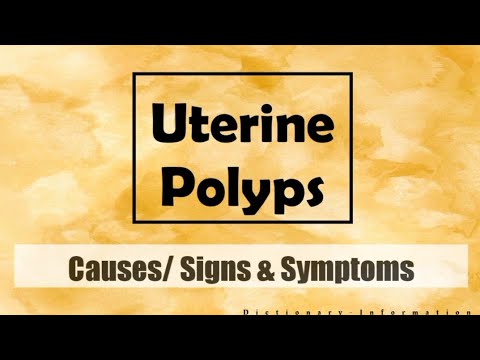 Uterine Polyps or Endometrial Polyps Meaning: Symptoms, Causes