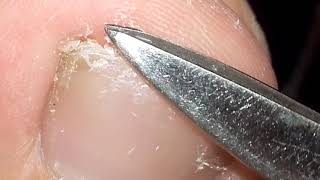 Cutting my toenail. Big toenail cut.