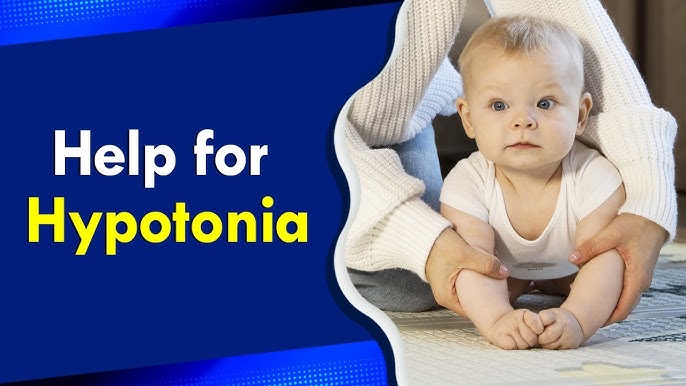 Hypotonia Explained: What You Need to Know - YouTube