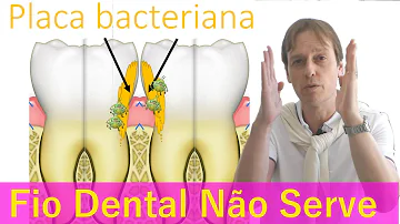 Qual a validade do fio dental?