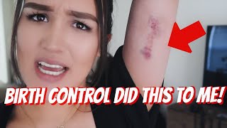 Hi guys! this was 6 weeks after i gave birth to my baby girl. that is
the time frame you must wait start up on your control giving birth..
thi...