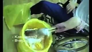Последствия приема дезоморфина Последствия приема дезоморфина