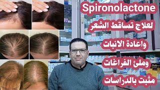 سبيرونولاكتون اقوي علاج لتساقط الشعر الهرموني عند النساء واعادة الانبات وملئ الفاغات/مثبت بالدراسات