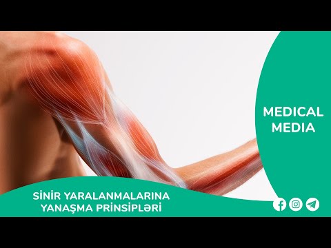 Video: MRI brakiyal pleksus zədəsini göstərəcəkmi?