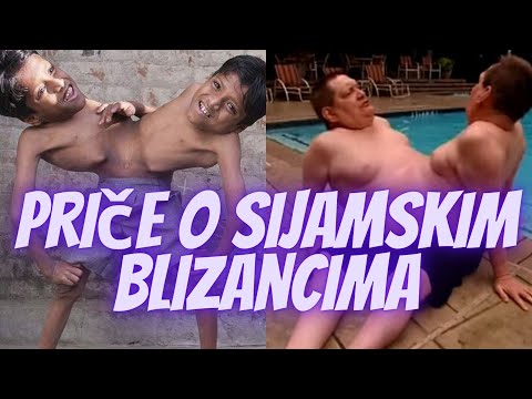 Video: 5 najupečatljivijih priča o blizancima