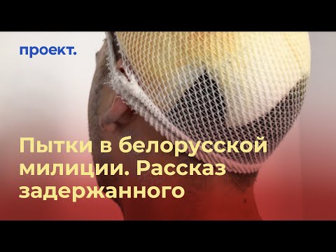 «Положили гранату в трусы»: жуткий рассказ о пытках в белорусской милиции