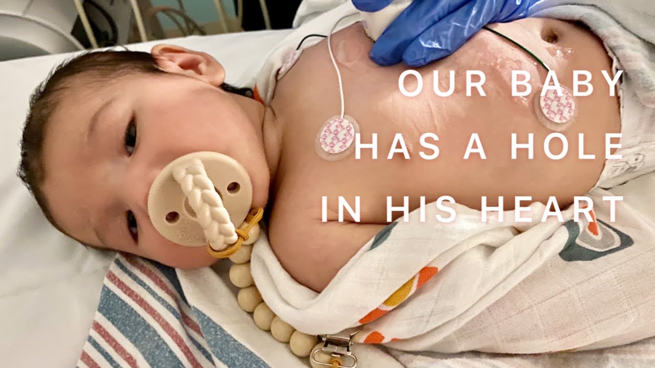 How we found out our son has a congenital heart defect | VSD | Ventricular Septal Defect | CHD