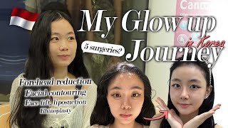 Famous I traveled 7 hours to get 5 surgeries in Korea ... | Jessica's glow up journey at BRAUN! (Part 1)✨ Wealth