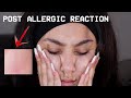 WASHING MY FACE WITH AN ALLERGY TO WATER. | Niah Selway