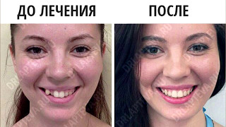 Установка брекетов в Москве - отзывы Установка брекетов в Москве - отзывы