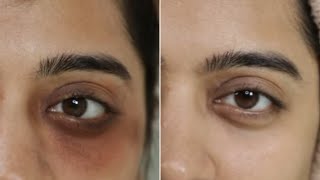 How I reduced my dark circles? | L'Oreal Paris Glycolic Bright Eye Serum @lorealparisindia by SuperWowStyle 205,072 views 3 months ago 4 minutes, 42 seconds