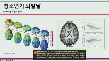 OHBM 2024 | Public Lecture | Journey into the World of Neuroimaging Research
