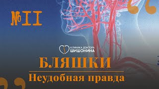 картинка: Бляшки и как с ними жить: рассказывает сосудистый хирург в новом выпуске «Хорошей медицины» 💊